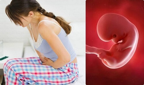 Dấu hiệu thai chết lưu